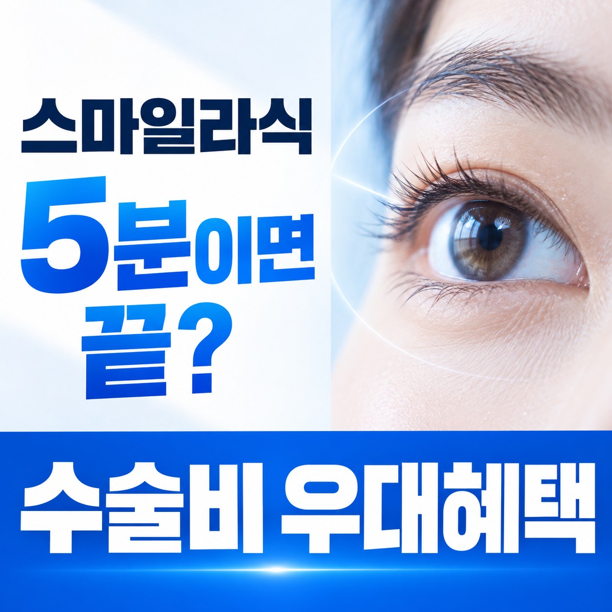 용산구 스마일라식 안내